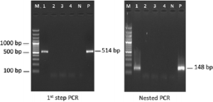 Co-infection of infectious myonecrosis virus and Enterocytozoon hepatopenaei in Penaeus vannamei farms in the east coast of India